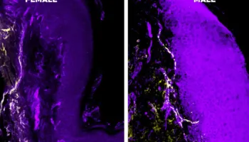 A zgjat dhimbja më shumë te gratë sesa te burrat?