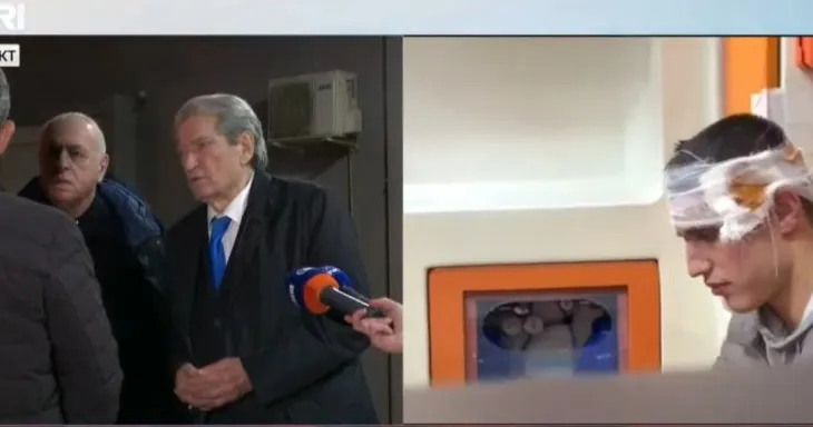Berisha nga spitali Traumës: 2 protestues me hematoma serioze, kanë marrë goditje në tru nga armët…