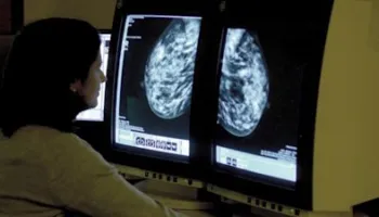 Britania prezanton planin 10-vjeçar kundër kancerit: 75% e pacientëve do ta mposhtin sëmundjen deri në 2035
