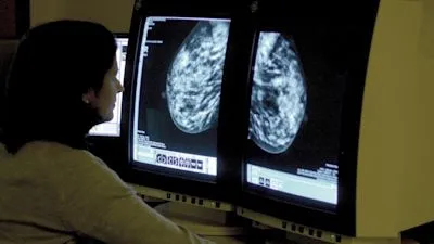 Britania prezanton planin 10-vjeçar kundër kancerit: 75% e pacientëve do ta mposhtin sëmundjen deri në 2035