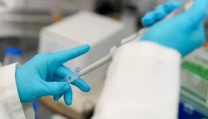 Dita Botërore e Kancerit: Këto janë shkaqet kryesore më të parandalueshme të kancerit, zbulon një studim i ri