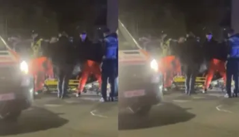 E goditën me leva metalike, i riu sulmohet barbarisht nga 3 persona