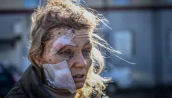 “Fytyra e parë e luftës”, 52-vjeçarja ukrainase kthehet në atdhe pas rehabilitimit dhe sfidon Putin: Dua ta takoj