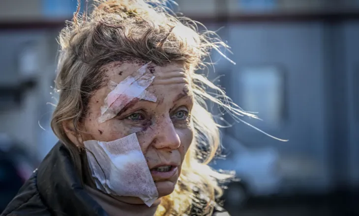 “Fytyra e parë e luftës”, 52-vjeçarja ukrainase kthehet në atdhe pas rehabilitimit dhe sfidon Putin: Dua ta takoj