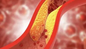 Hulumtimi/ Kolesteroli i lartë shoqërohet me jetëgjatësi më të madhe