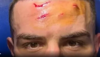 Krstovic tregon “takat” e penalltisë vendimtare. CDK dhe Samardzic njëzëri: Heroi ynë…