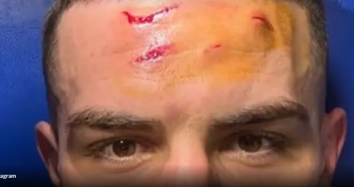 Krstovic tregon “takat” e penalltisë vendimtare. CDK dhe Samardzic njëzëri: Heroi ynë…