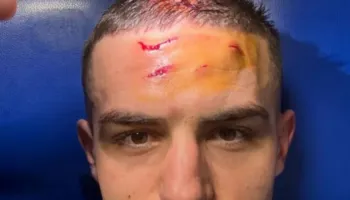 Krstović zbulon shenjat e takave në kokë, që sollën penalltinë në minutat shtesë të ndeshjes, për mrekullinë e Atalantës