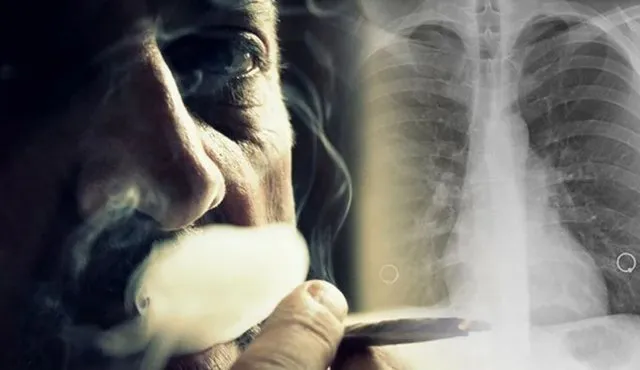 KUJDES/ Përdorimi i cigareve elektronike, ja çfarë u ndodh mushkërive tuaja kur thithni tymin nga të tjerët