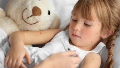 Lija në rënie në Evropë, por OBSH-ja është e shqetësuar për Amerikën e Veriut