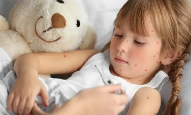 Lija në rënie në Evropë, por OBSH-ja është e shqetësuar për Amerikën e Veriut