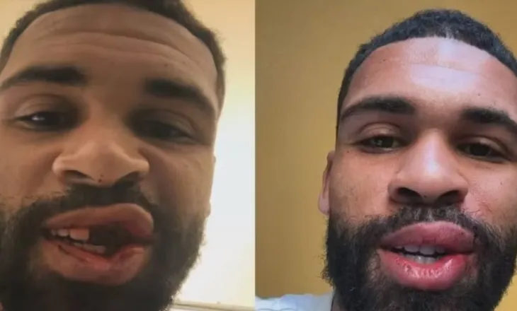 Loftus-Cheek publikon veten pa dhëmbë, më pas falenderon të gjithë për mbështetjen: Më e keqja ka kaluar