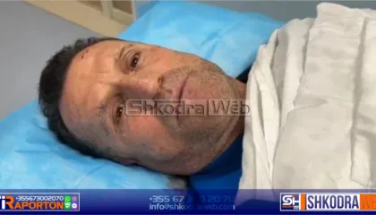 “Më goditën pas koke!”, u dhunua në Vlorë, flet avokati i Ilir Metës: Njëri më ofendoi, tjetri më qëlloi!