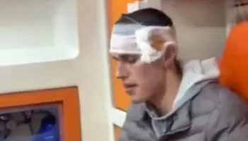 Me plagë në kokë, policia e dhunon protestuesin në komisariat dhe refuzon ta dërgojë në spital