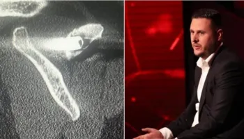 “Na hodhën në kamionin me viktima”/ I mbijetuari i masakrës së Suharekës rrëfen tmerrin: Kam 27 vite me plumb në trup