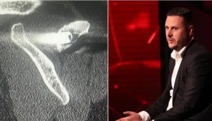 “Na hodhën në kamionin me viktima”/ I mbijetuari i masakrës së Suharekës rrëfen tmerrin: Kam 27 vite me plumb në trup