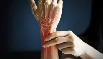 Ndalojini menjëherë këto 3 gjëra nëse doni të mbroni shëndetin e kockave