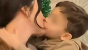 Pediatrët italianë paralajmërojnë për puthjet në buzë me fëmijët: Rreziqe infektive dhe psikologjike