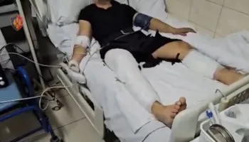 Policia e Shtetit bën bilancin: 16 efektivë përfunduan në spital (Video)