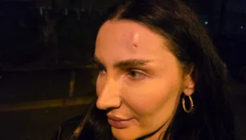 Policia qëllon me plumb gome ish-kandidaten për deptuete