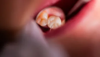 Pse dhëmbi dhemb më shumë natën – dhe si ta trajtoni atë