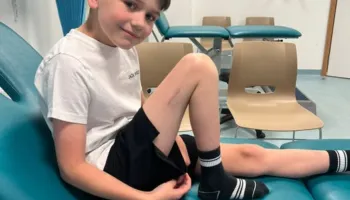 Revolucion në mjekësi/ 9-vjeçari në Britani bëhet fëmija i parë që iu nënshtrua një operacioni për zgjatjen e këmbës