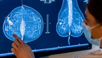 Si mund të ndikojë mjedisi në rrezikun e kancerit të gjirit