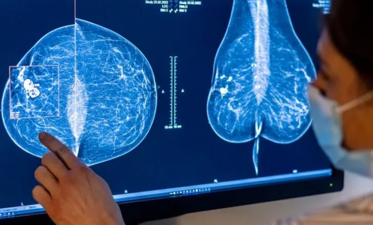 Si mund të ndikojë mjedisi në rrezikun e kancerit të gjirit