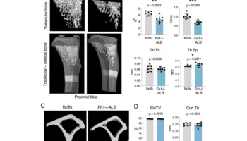 Studimi: Proteina e prodhuar në mëlçi është faktor kyç për shëndetin e kockave te meshkujt
