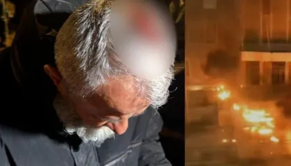 Tensionet para Kryeministrisë, një protestues plagoset në kokë