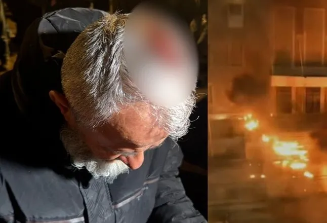 Tensionet para Kryeministrisë, një protestues plagoset në kokë