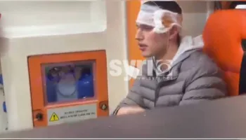 VIDEO/ Me plagë të shumta në kokë, ky është një nga protestuesit e dhunuar nga policia