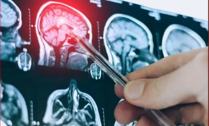 Zbulim i madh për demencën dhe kujtesën