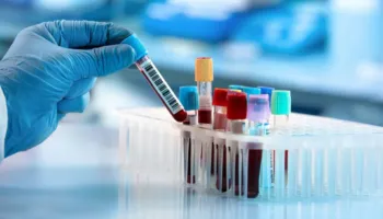 47-vjeçarja shqiptare humb jetën pas diagnozës së gabuar, familja dëmshpërblehet me 300 mijë euro