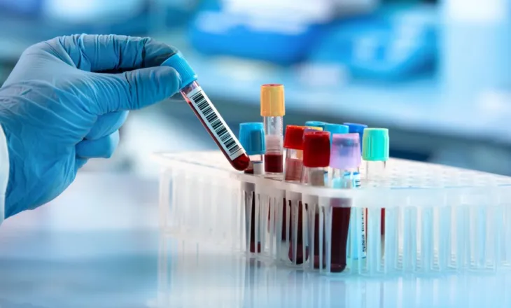 47-vjeçarja shqiptare humb jetën pas diagnozës së gabuar, familja dëmshpërblehet me 300 mijë euro