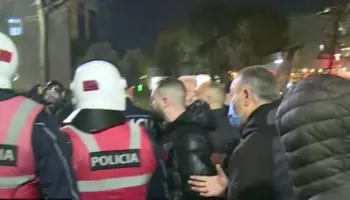 Çfarë po ndodh? Sali Berishës i hedhin spraj dhe ujë në sy, ja si paraqitet gjendja e tij