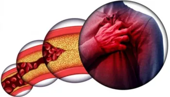 E vërteta për kolesterolin që nuk jua thonë