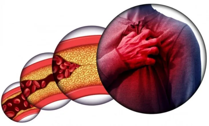 E vërteta për kolesterolin që nuk jua thonë