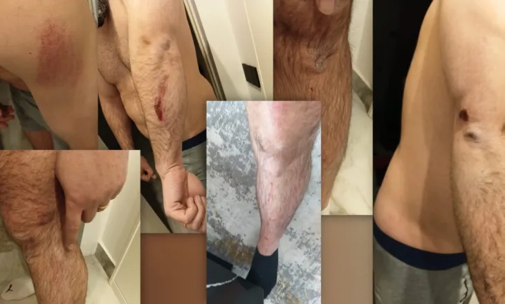 FOTO / Protestuesit e Rrjollit rrahin brutalisht pas emisionit djalin e trashëgimtarit të tokës