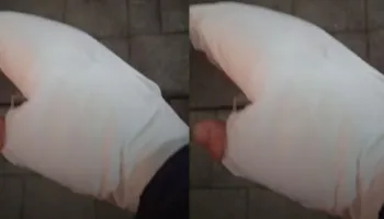 Fotoreporteri përfundon në spital/ U godit në dorë pasi molotovët u hodhën drejt vilës së ish-diktatorit Hoxha