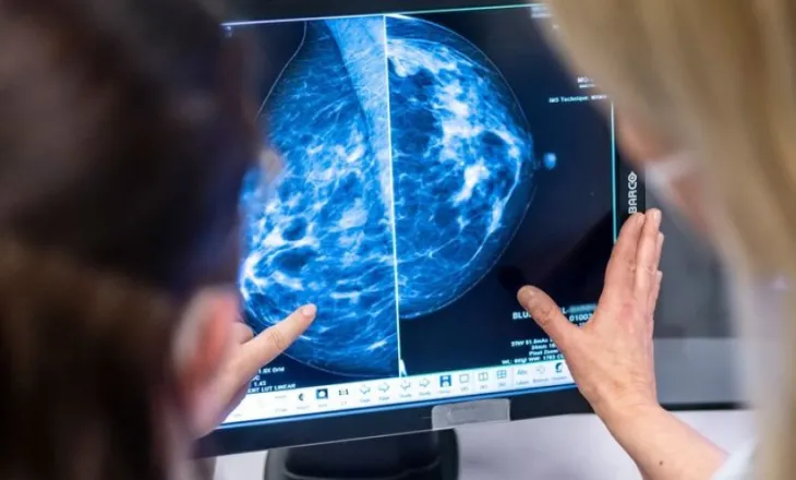 Gjashtë faktorë që parandalojnë kancerin e gjirit