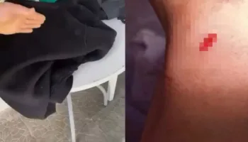 I mituri e goditi 16-vjeçarin 4 herë me thikë/ Si sherri mes dy te miturve mund te kishte perfunduar ne tragjedi