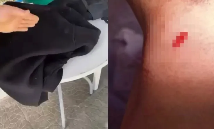 I mituri e goditi 16-vjeçarin 4 herë me thikë/ Si sherri mes dy te miturve mund te kishte perfunduar ne tragjedi