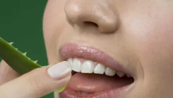 Keni probleme me shëndetin e dhëmbëve? Mësoni si ta kuroni me aloe vera