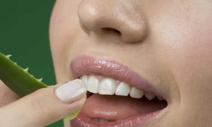 Keni probleme me shëndetin e dhëmbëve? Mësoni si ta kuroni me aloe vera