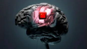 Kina ka miratuar implantin e parë të trurit në botë për komercializim