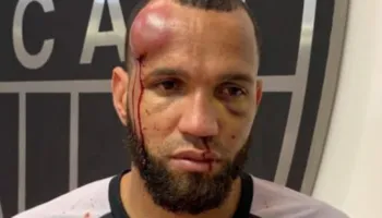 Koka bën, koka e pëson… Ja si përfundoi portieri që nisi sherrin e finales me 23 kartonë të kuq