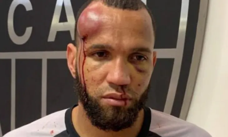 Koka bën, koka e pëson… Ja si përfundoi portieri që nisi sherrin e finales me 23 kartonë të kuq