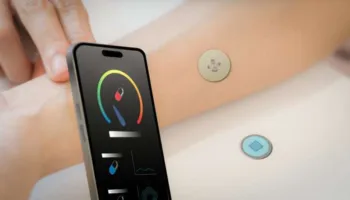 Leukoplasti inteligjent zbulon alergjitë para se të shfaqen simptomat