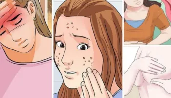 Njihuni me 5 ushqimet që mbajnë në kontroll çrregullimet hormonale